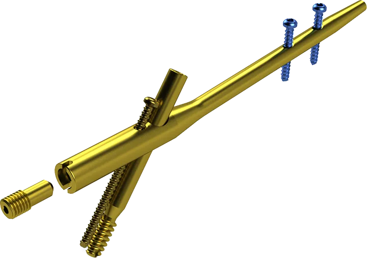 Sartori titanium locked intramedullary nail