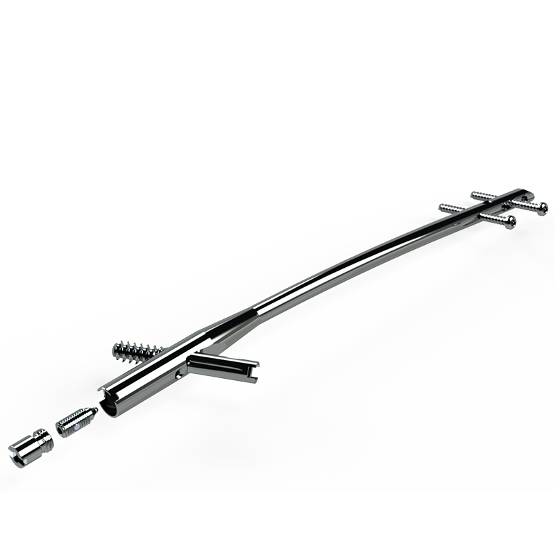 Haste Intramedular Bloqueada