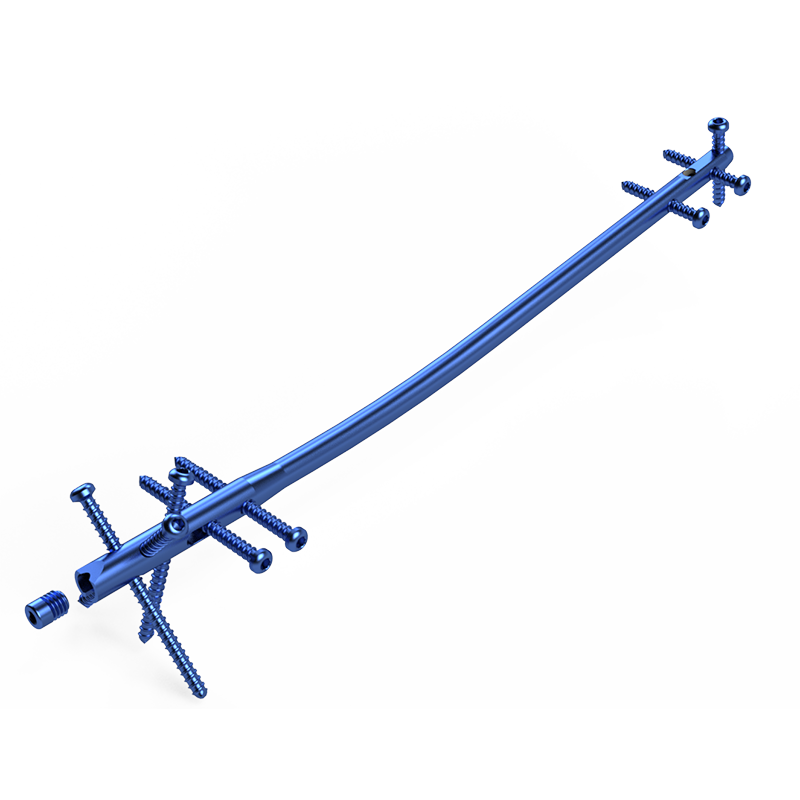 Haste Intramedular Bloqueada em Titânio