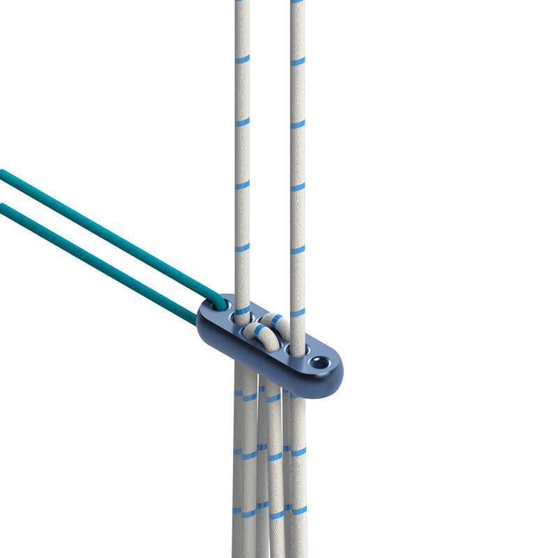 Placa E-Button Ajustável para Fixação Ligamentar